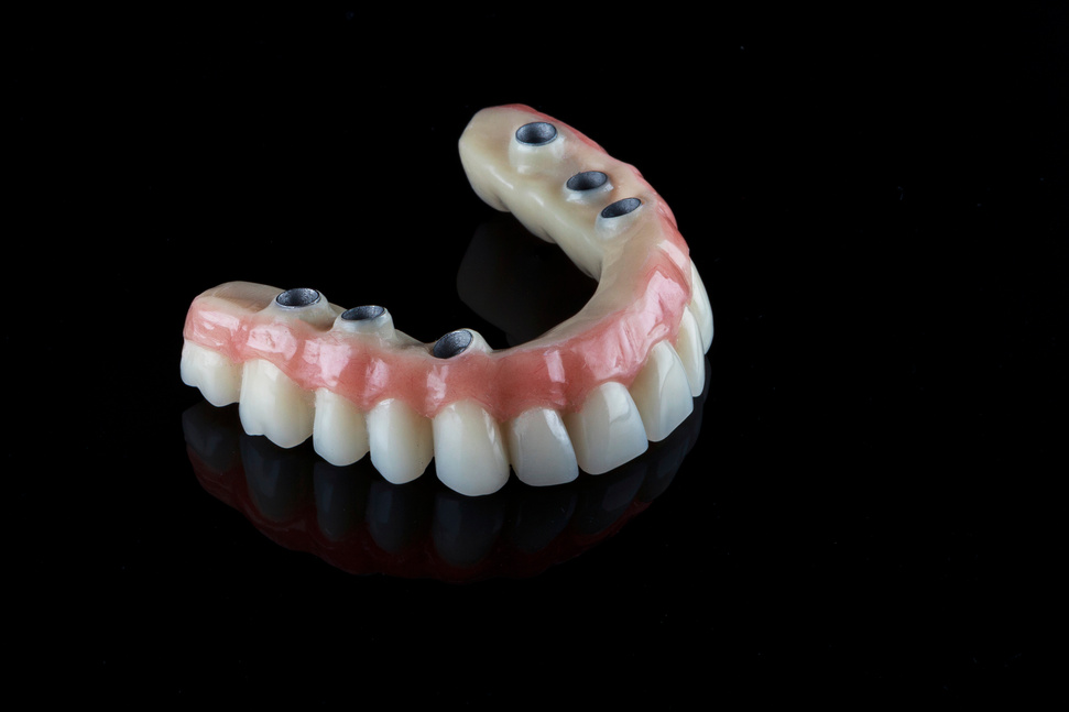 Realistic Dental Permanent Prosthesis Upper Jaw with a Blank Bla